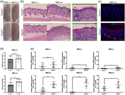 Sphingosine 1-phosphate receptor 2 in keratinocytes plays a key role in reducing inflammation in psoriasis